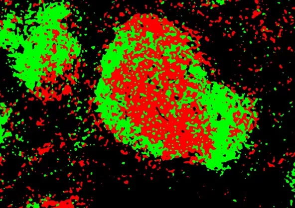 Automatic recognition and localization of different cell types